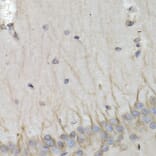 Immunohistochemistry - Anti-PSMB10/MECL1 Antibody (A14770) - Antibodies.com