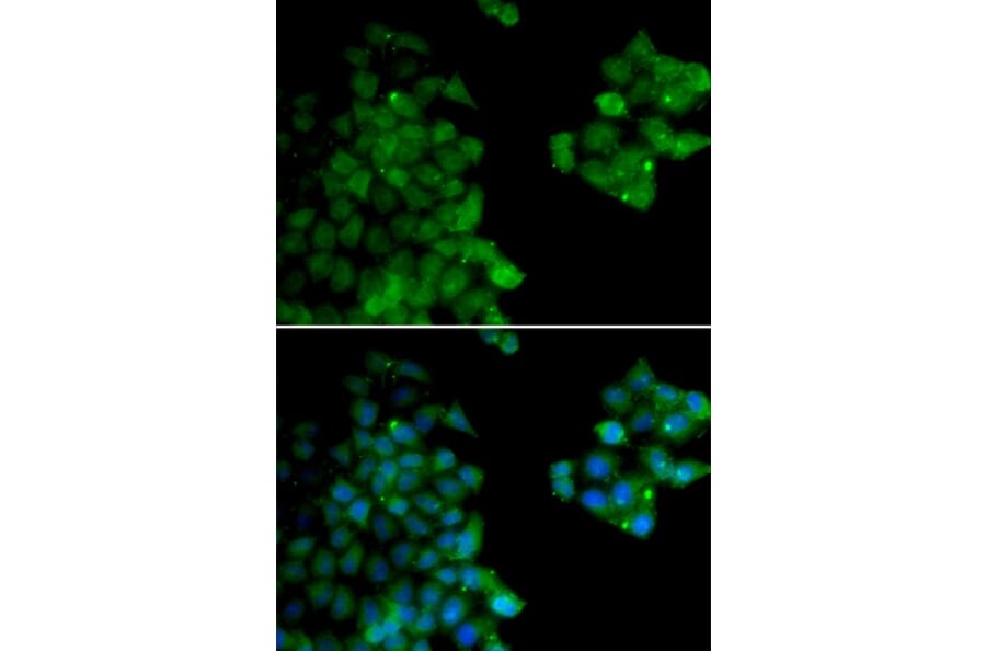 Immunofluorescence - Anti-PSMB10/MECL1 Antibody (A14770) - Antibodies.com