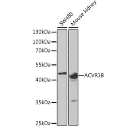 Western Blot - Anti-ACVR1B Antibody (A5453) - Antibodies.com