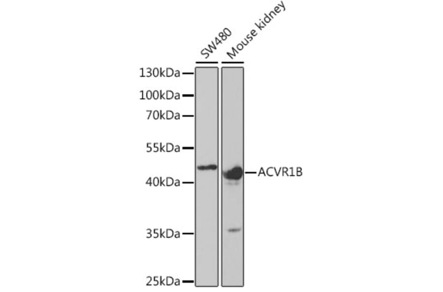 Western Blot - Anti-ACVR1B Antibody (A5453) - Antibodies.com