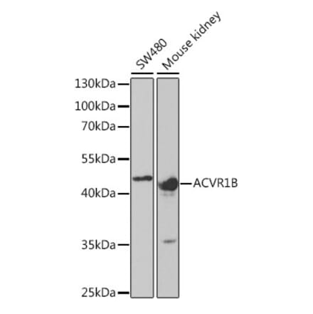 Western Blot - Anti-ACVR1B Antibody (A5453) - Antibodies.com