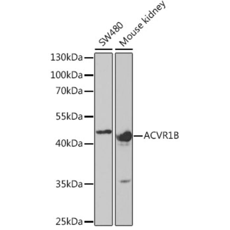 Western Blot - Anti-ACVR1B Antibody (A5453) - Antibodies.com