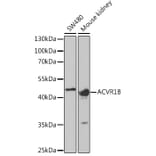 Western Blot - Anti-ACVR1B Antibody (A5453) - Antibodies.com