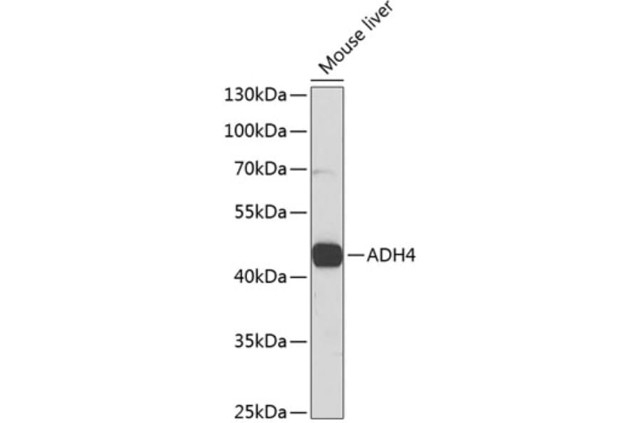Western Blot - Anti-ADH4 Antibody (A14772) - Antibodies.com
