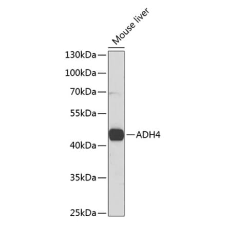 Western Blot - Anti-ADH4 Antibody (A14772) - Antibodies.com