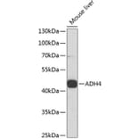 Western Blot - Anti-ADH4 Antibody (A14772) - Antibodies.com