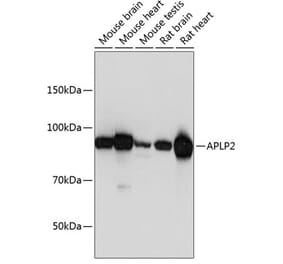 Western Blot - Anti-APLP2 Antibody (A14773) - Antibodies.com