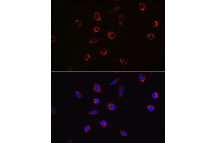 Immunofluorescence - Anti-APLP2 Antibody (A14773) - Antibodies.com