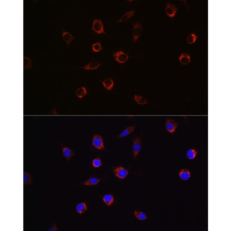Immunofluorescence - Anti-APLP2 Antibody (A14773) - Antibodies.com