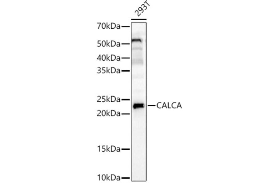 Western Blot - Anti-APRT Antibody (A14774) - Antibodies.com