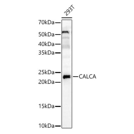 Western Blot - Anti-APRT Antibody (A14774) - Antibodies.com