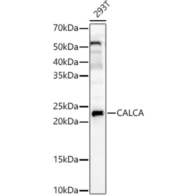 Western Blot - Anti-APRT Antibody (A14774) - Antibodies.com