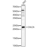 Western Blot - Anti-APRT Antibody (A14774) - Antibodies.com