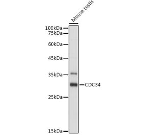 Western Blot - Anti-Cdc34 Antibody (A14775) - Antibodies.com