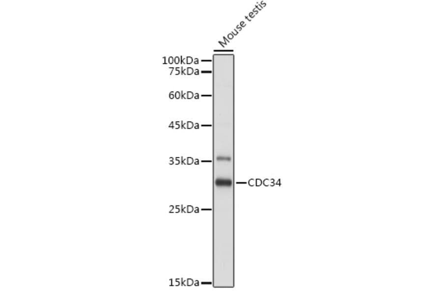Western Blot - Anti-Cdc34 Antibody (A14775) - Antibodies.com