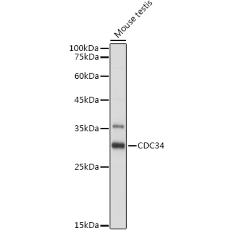 Western Blot - Anti-Cdc34 Antibody (A14775) - Antibodies.com