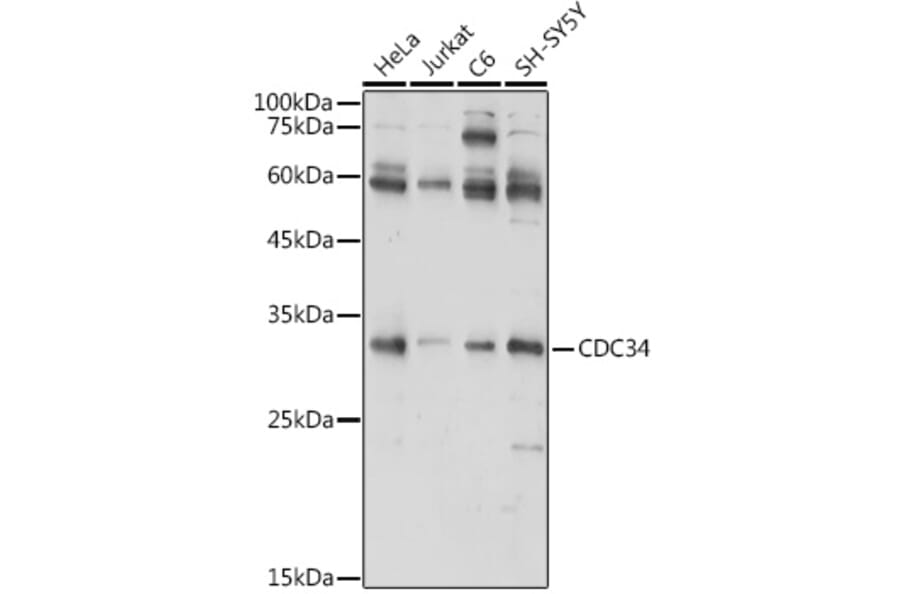 Western Blot - Anti-Cdc34 Antibody (A14775) - Antibodies.com