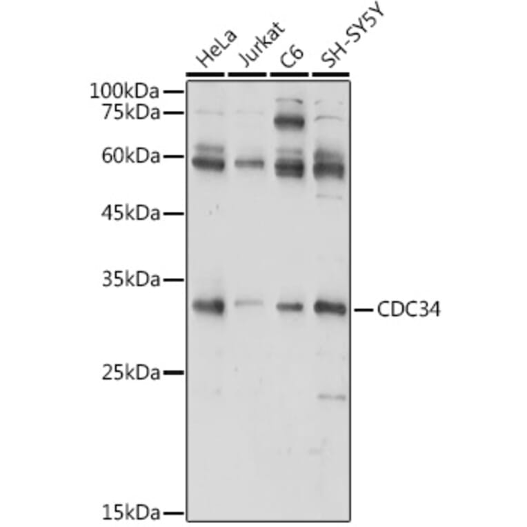 Western Blot - Anti-Cdc34 Antibody (A14775) - Antibodies.com