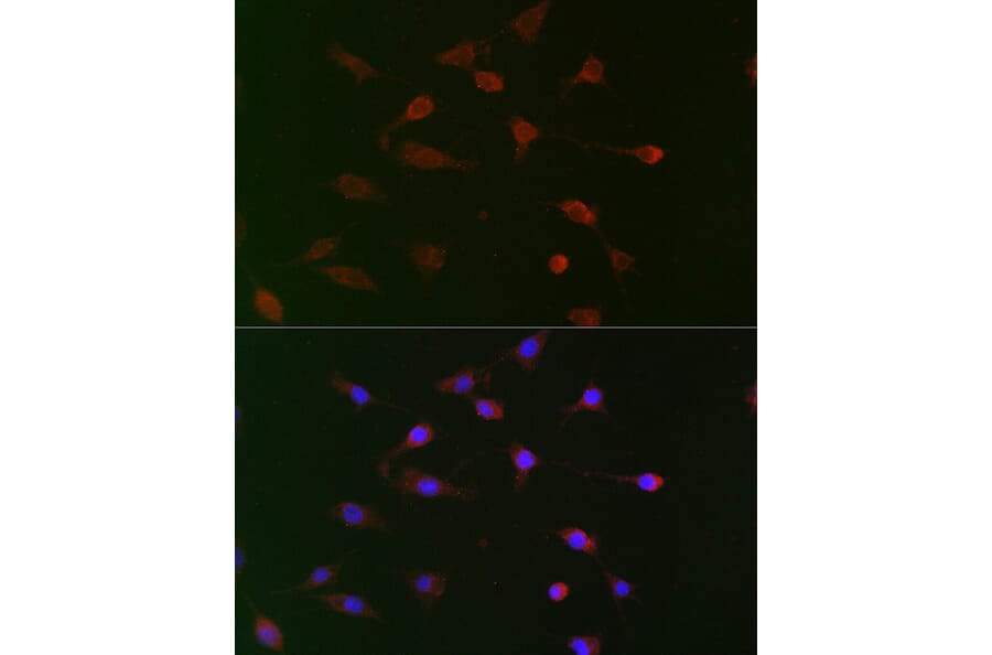 Immunofluorescence - Anti-Cdc34 Antibody (A14775) - Antibodies.com