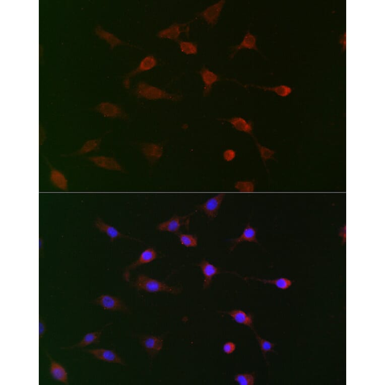 Immunofluorescence - Anti-Cdc34 Antibody (A14775) - Antibodies.com