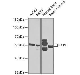 Western Blot - Anti-CPE Antibody (A14776) - Antibodies.com