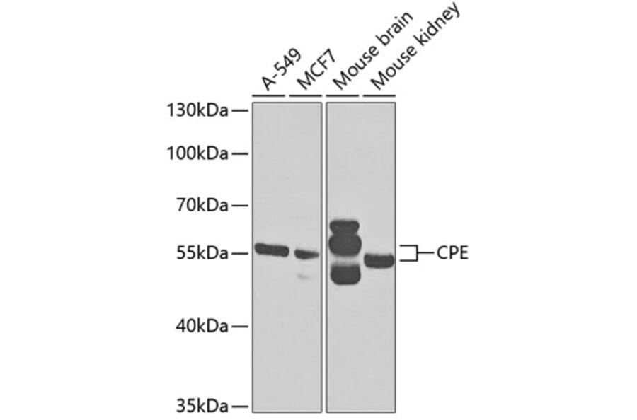 Western Blot - Anti-CPE Antibody (A14776) - Antibodies.com