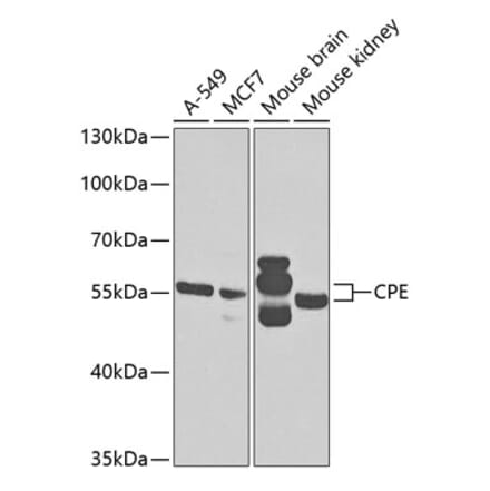 Western Blot - Anti-CPE Antibody (A14776) - Antibodies.com
