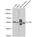 Western Blot - Anti-CPE Antibody (A14776) - Antibodies.com