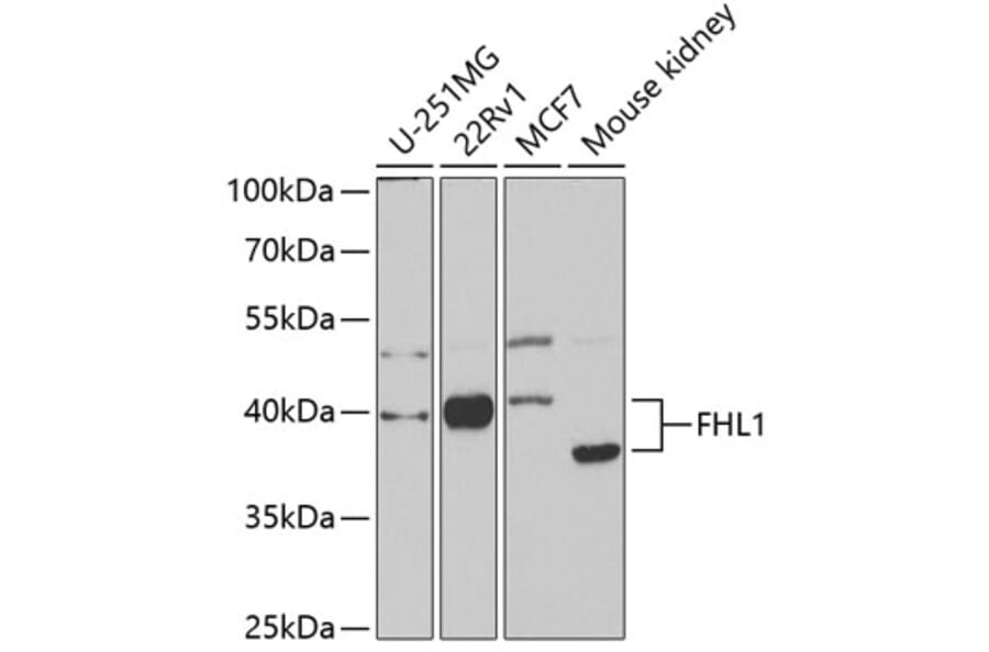 Western Blot - Anti-FHL1 Antibody (A14777) - Antibodies.com