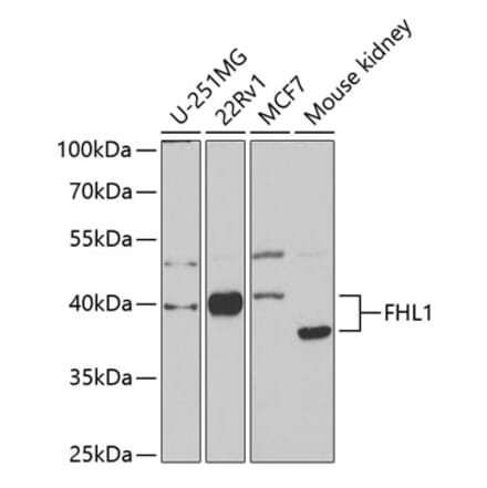 Western Blot - Anti-FHL1 Antibody (A14777) - Antibodies.com