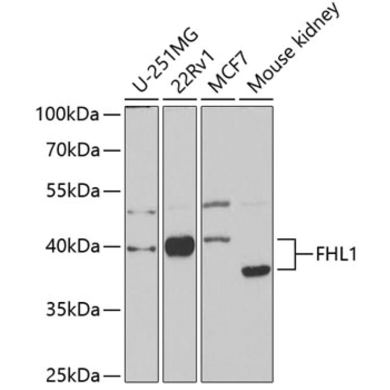 Western Blot - Anti-FHL1 Antibody (A14777) - Antibodies.com