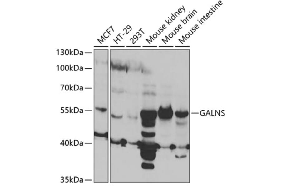 Western Blot - Anti-GALNS/Chondroitinase Antibody (A14778) - Antibodies.com