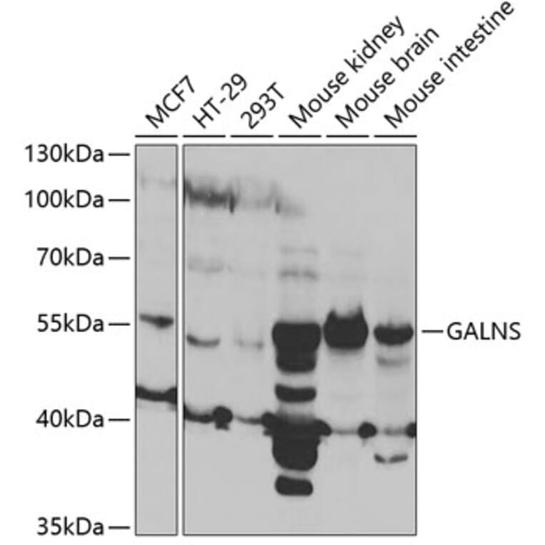 Western Blot - Anti-GALNS/Chondroitinase Antibody (A14778) - Antibodies.com