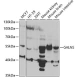 Western Blot - Anti-GALNS/Chondroitinase Antibody (A14778) - Antibodies.com