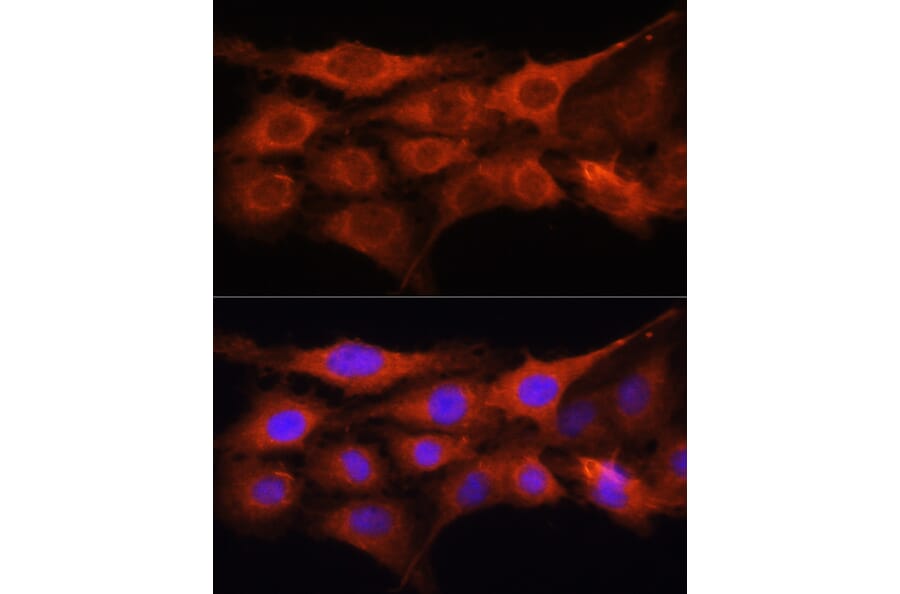 Immunofluorescence - Anti-GALNS/Chondroitinase Antibody (A14778) - Antibodies.com