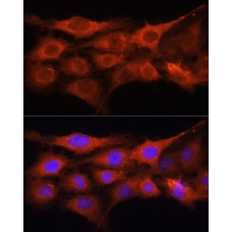 Immunofluorescence - Anti-GALNS/Chondroitinase Antibody (A14778) - Antibodies.com