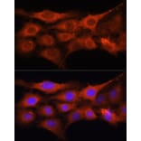 Immunofluorescence - Anti-GALNS/Chondroitinase Antibody (A14778) - Antibodies.com