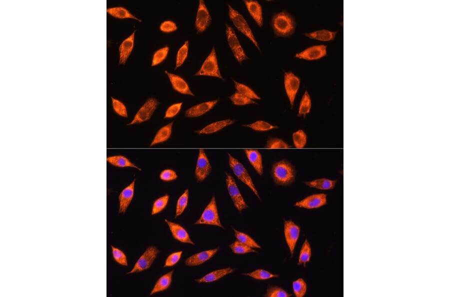 Immunofluorescence - Anti-GALNS/Chondroitinase Antibody (A14778) - Antibodies.com