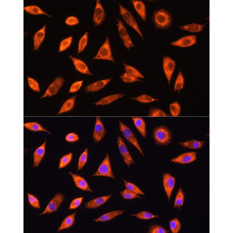 Immunofluorescence - Anti-GALNS/Chondroitinase Antibody (A14778) - Antibodies.com