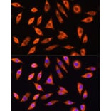 Immunofluorescence - Anti-GALNS/Chondroitinase Antibody (A14778) - Antibodies.com