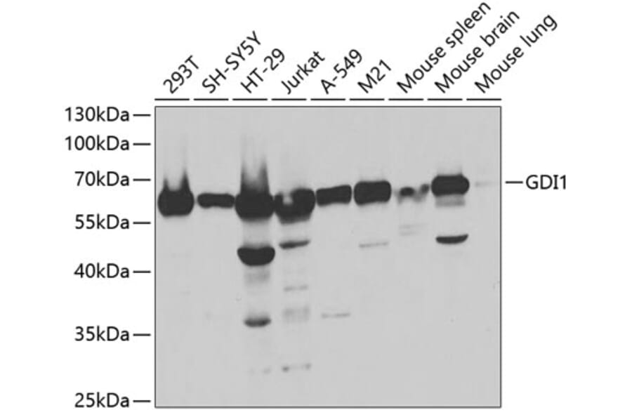 Western Blot - Anti-GDI1 Antibody (A5462) - Antibodies.com