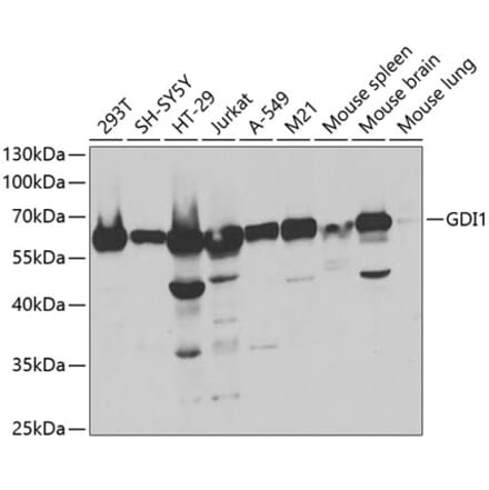 Western Blot - Anti-GDI1 Antibody (A14779) - Antibodies.com