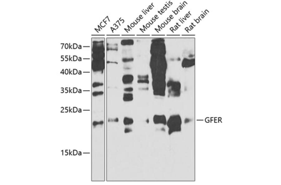 Western Blot - Anti-ALR/HPO Antibody (A14780) - Antibodies.com