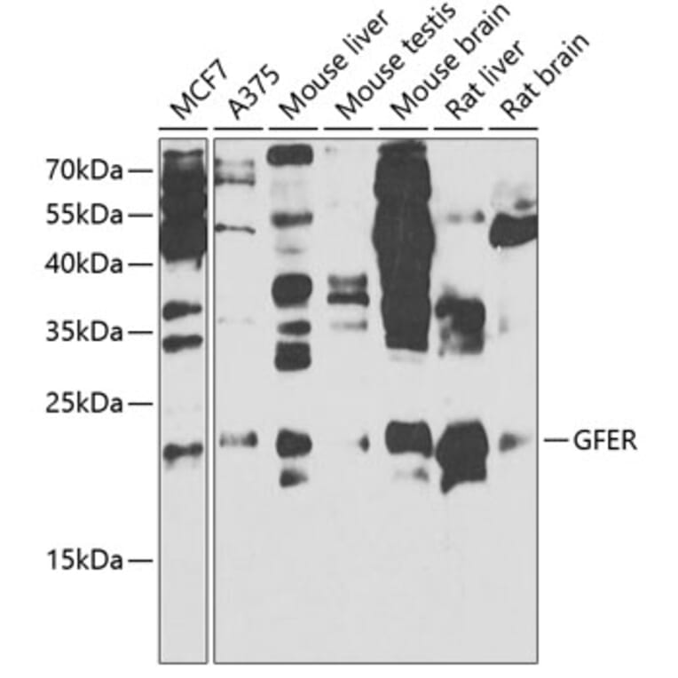 Western Blot - Anti-ALR/HPO Antibody (A14780) - Antibodies.com