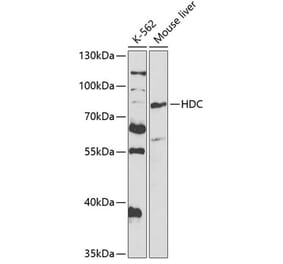 Western Blot - Anti-Histidine decarboxylase Antibody (A14781) - Antibodies.com