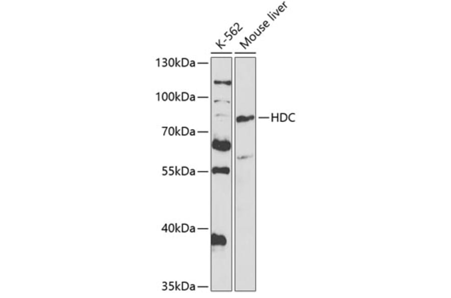Western Blot - Anti-Histidine decarboxylase Antibody (A14781) - Antibodies.com