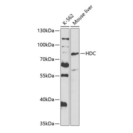 Western Blot - Anti-Histidine decarboxylase Antibody (A14781) - Antibodies.com