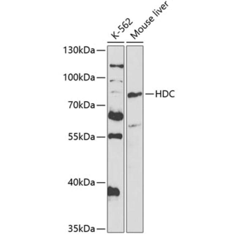 Western Blot - Anti-Histidine decarboxylase Antibody (A14781) - Antibodies.com