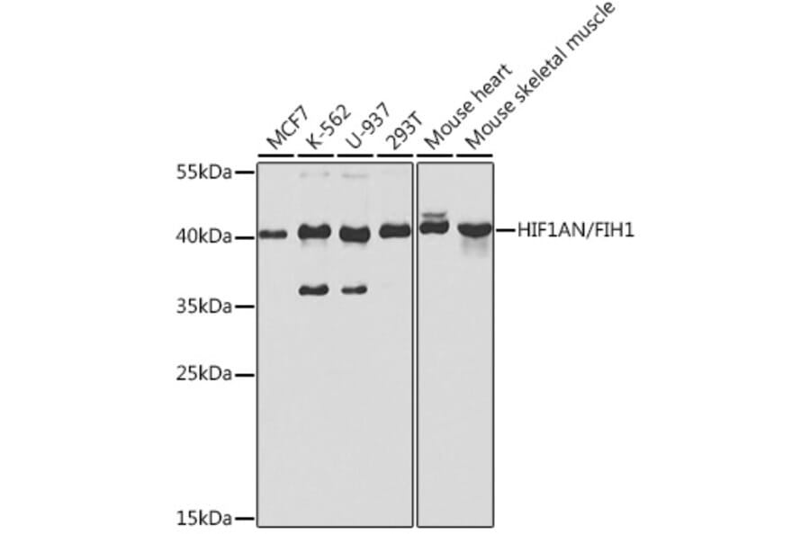 Western Blot - Anti-HIF1AN/FIH-1 Antibody (A14782) - Antibodies.com