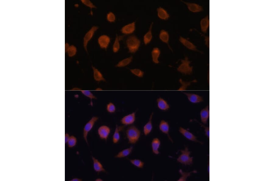 Immunofluorescence - Anti-HIF1AN/FIH-1 Antibody (A14782) - Antibodies.com